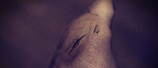 Michael Reschke Fuß